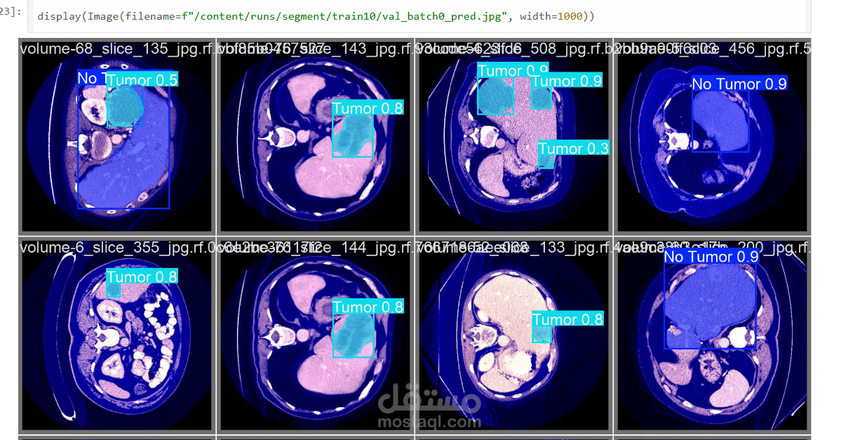 Liver-tumor-segmentation