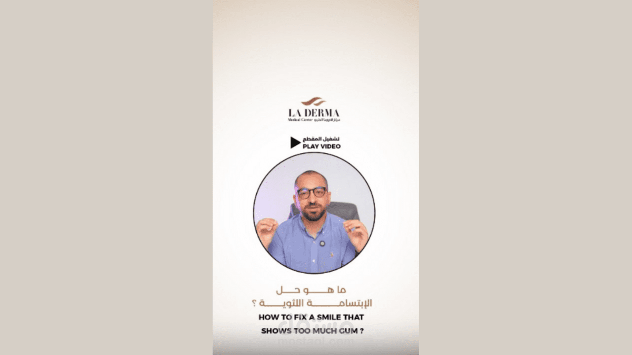 gummy smile ( medical )