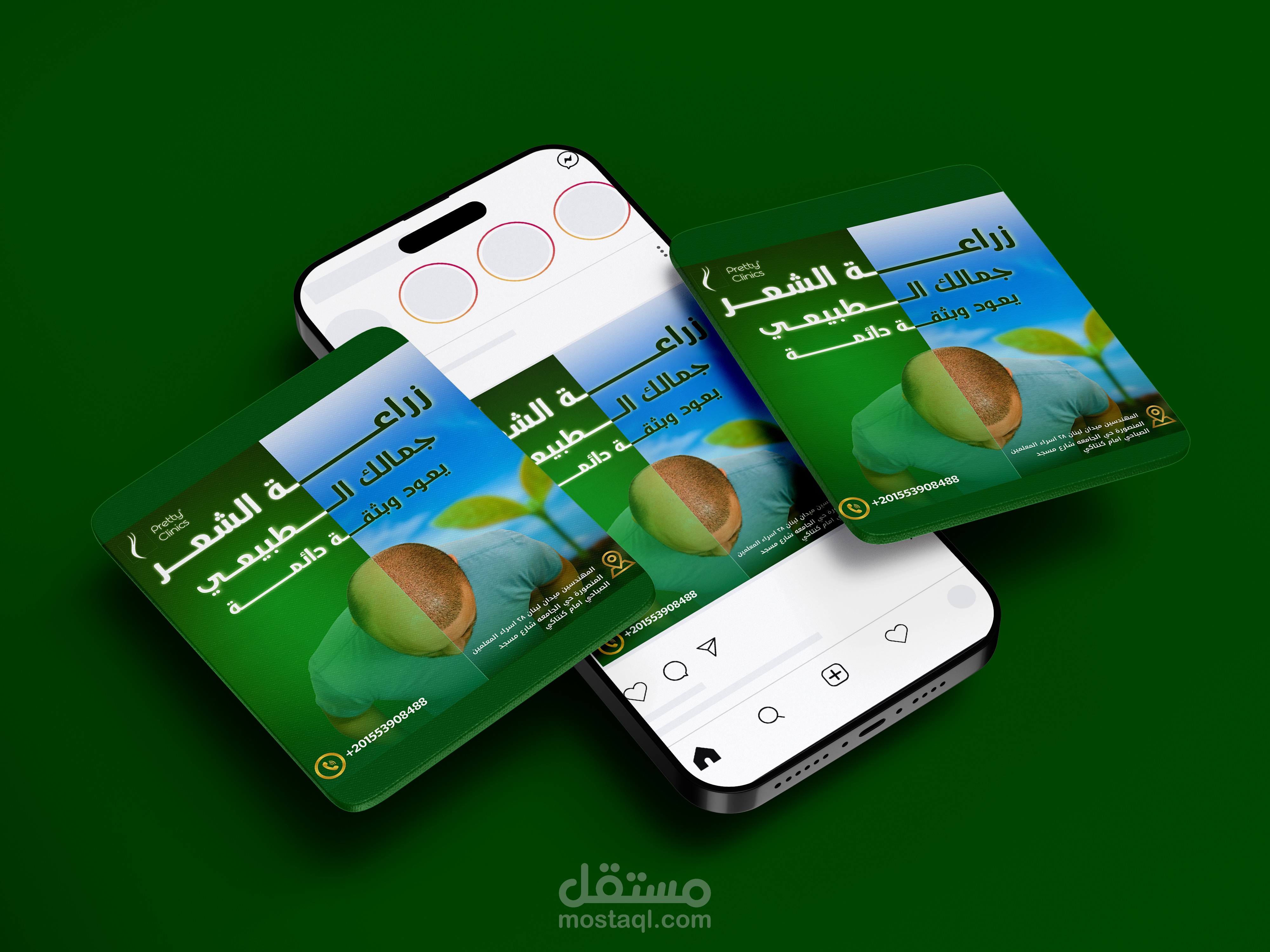 تصميم لمركز زراعة الشعر