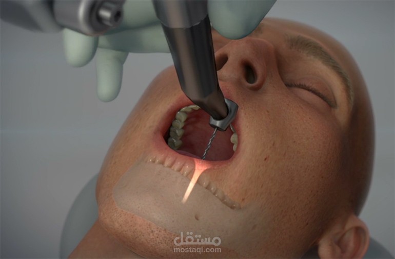 استخدامات الذكاء الاصطناعي في مجال طب الاسنان