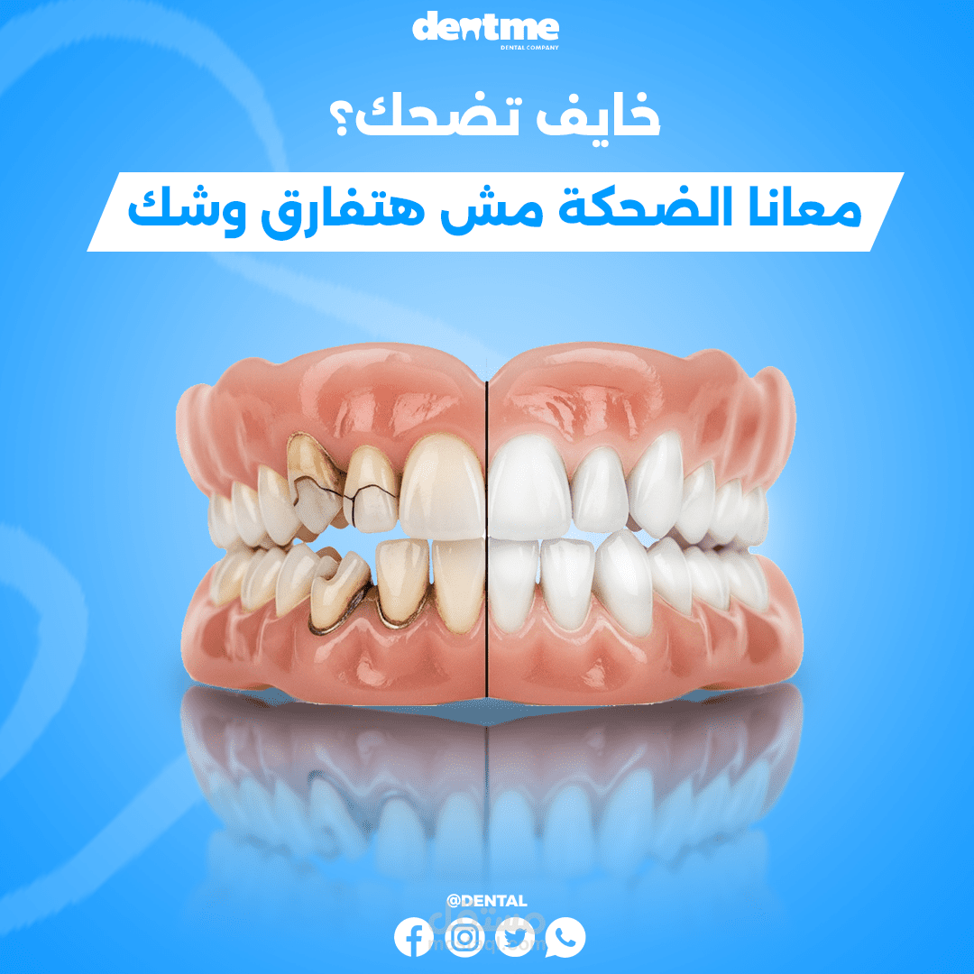 تصميم سوشيال ميديا لبراند اسنان (وهمي)