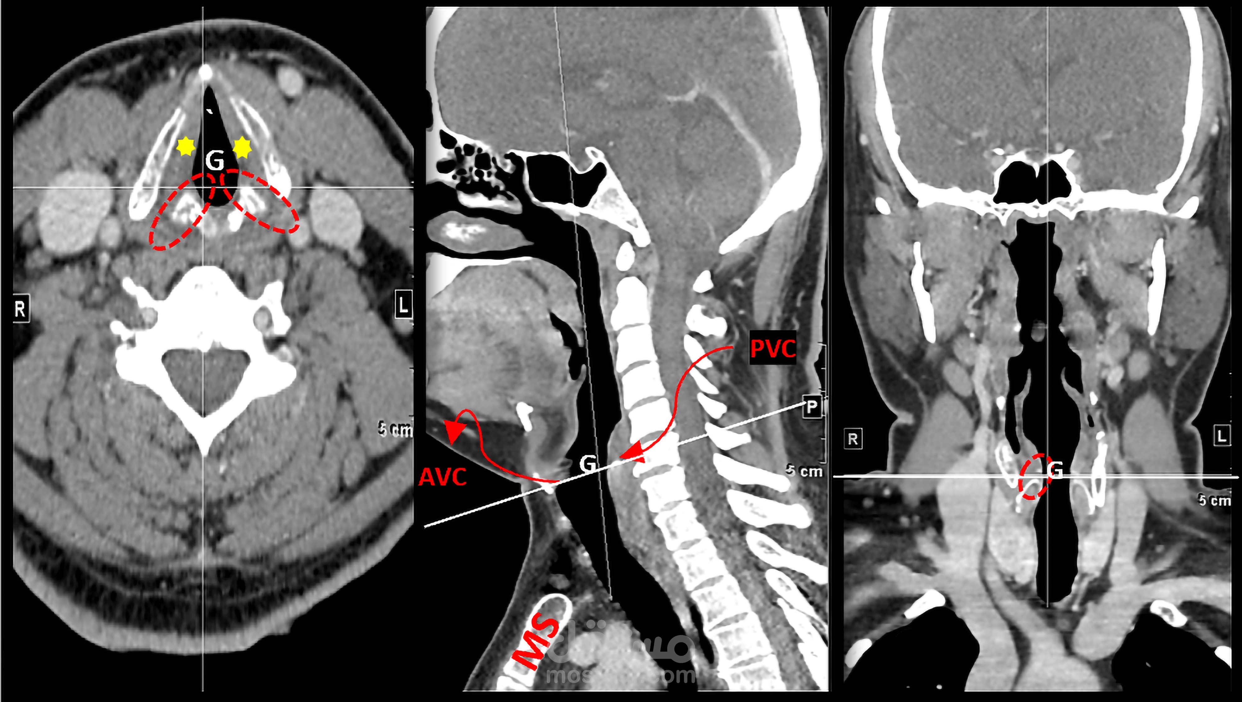 تحسين جودة دوقة الصورة باحترافية كبيرة