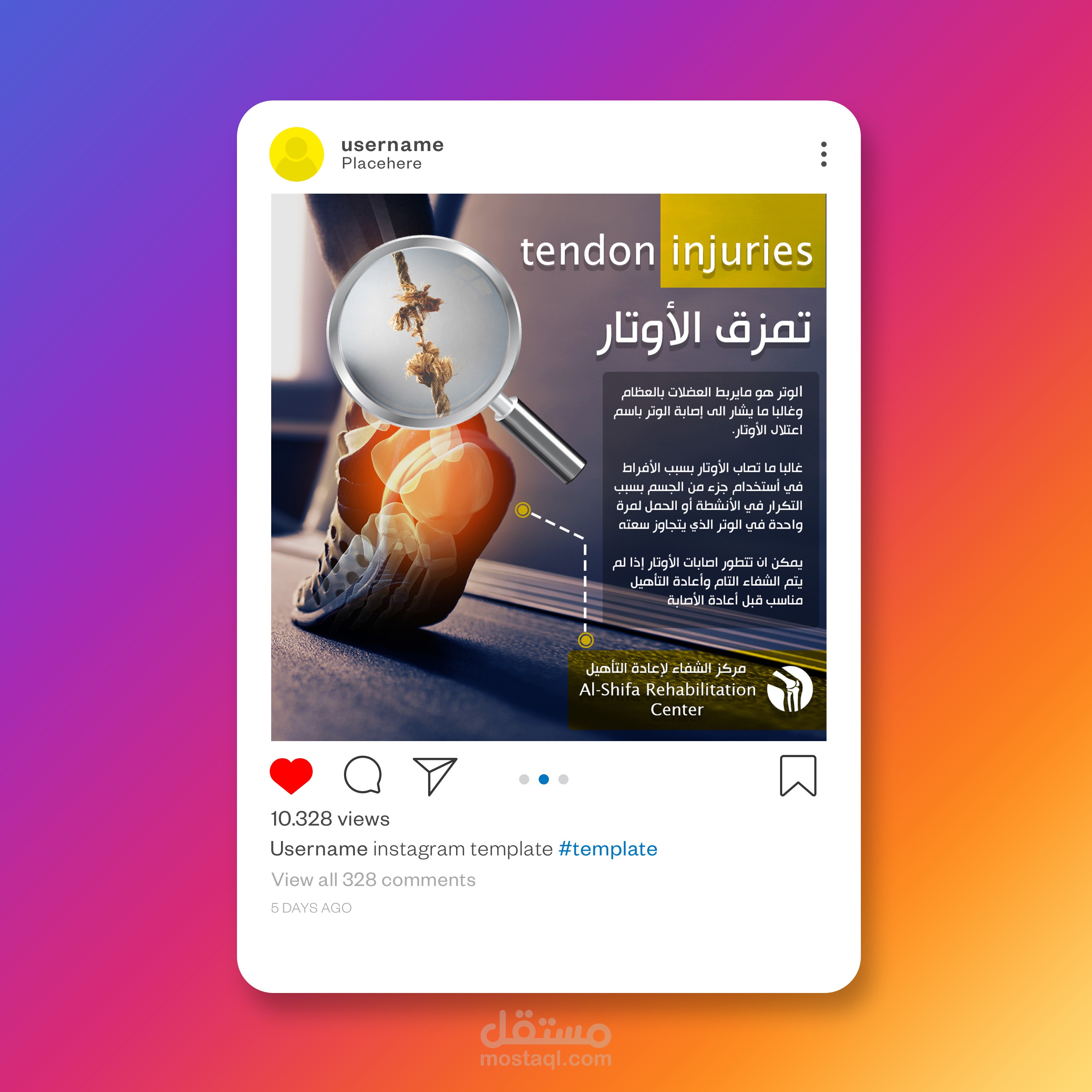 تمزق الأوتار