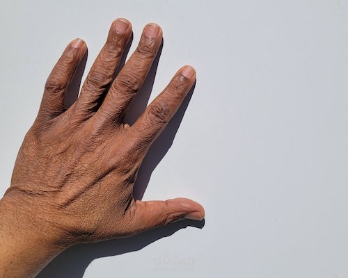 Home Remedies For Finger Swelling