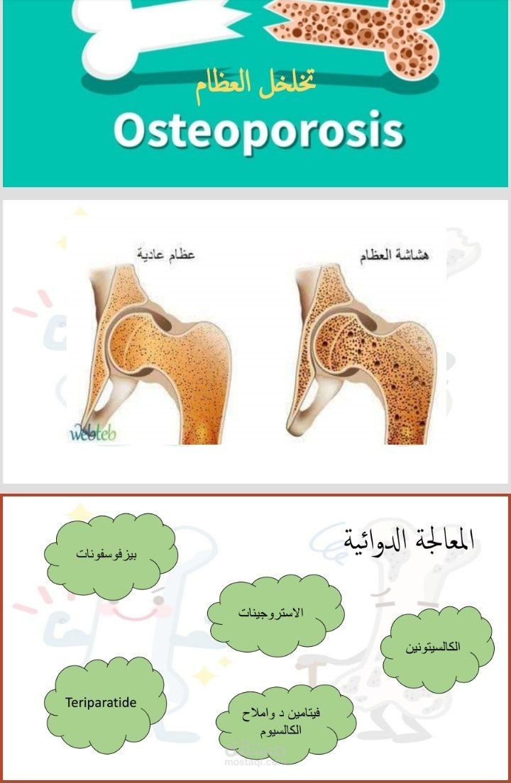 عرض تقديمي عن موضوع طبي