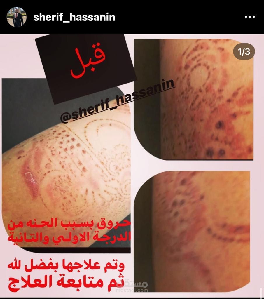 تسويق وتعديل صور