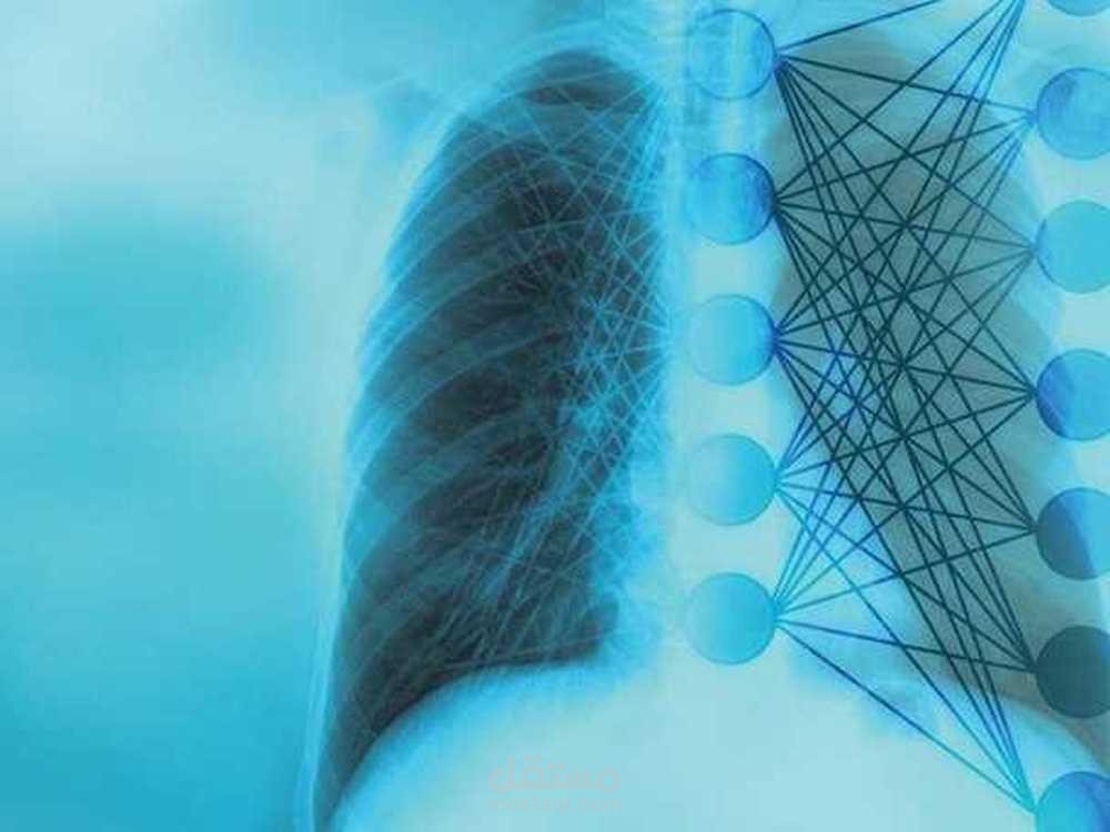Pneumonia Detection