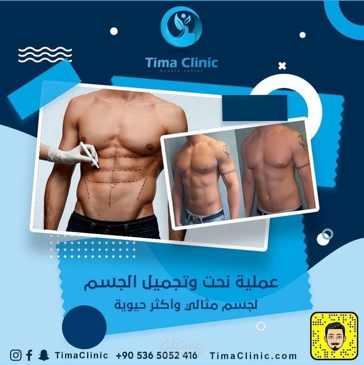 اعلان تجميلي