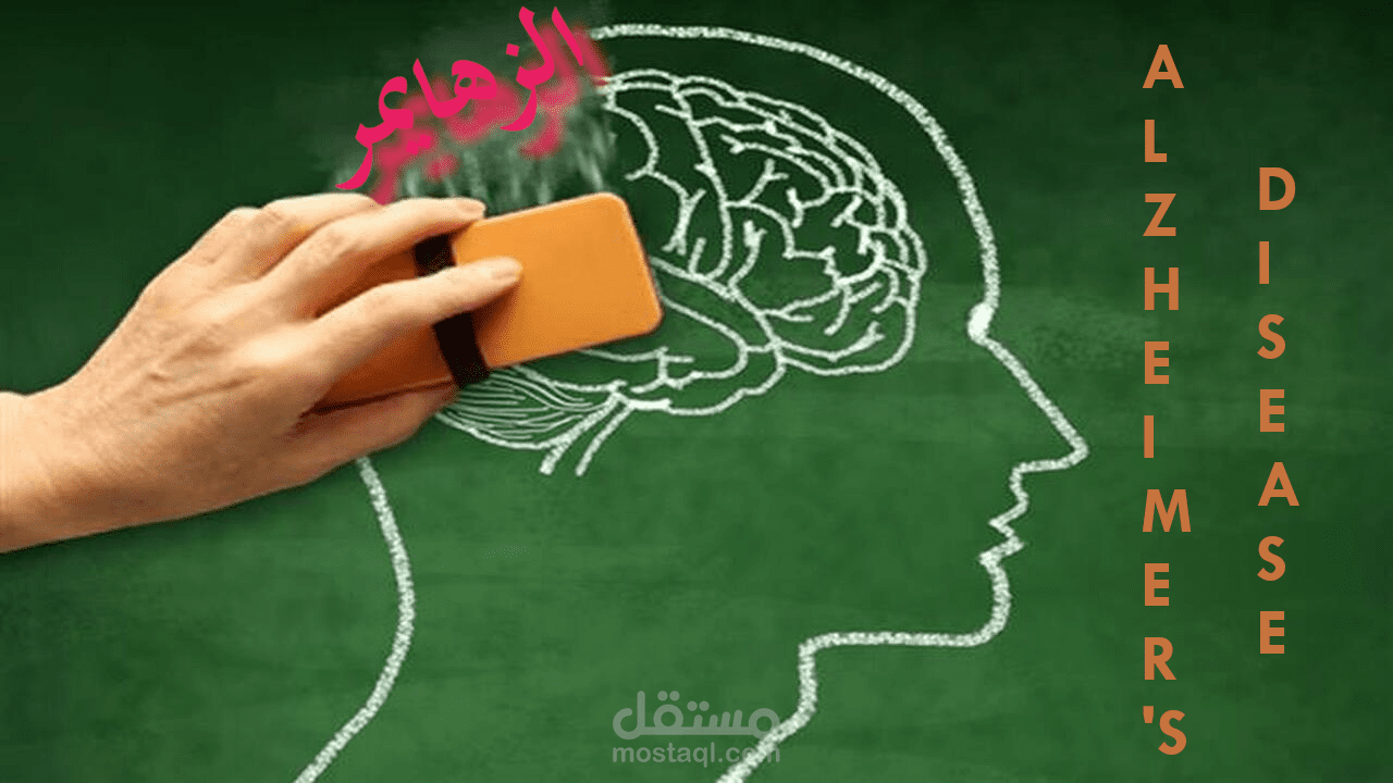 مرض الزهايمر
