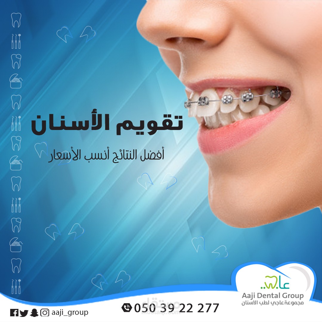 تقويم الاسنان