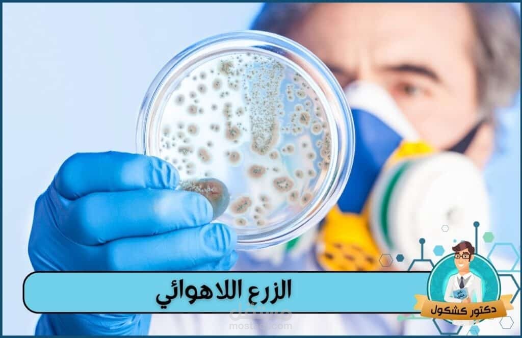 كتابة محتوى تحاليل طبية متوافق مع قواعد السيو
