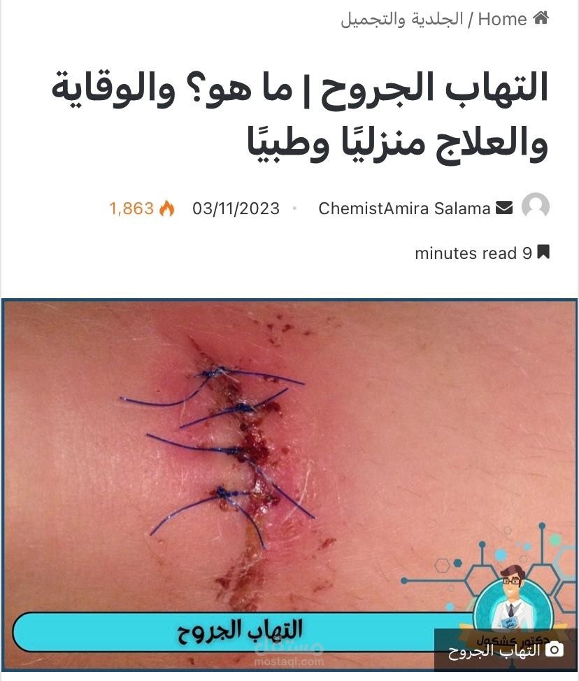 كتابة مقالات طبية متوافقة مع معايير محركات البحث