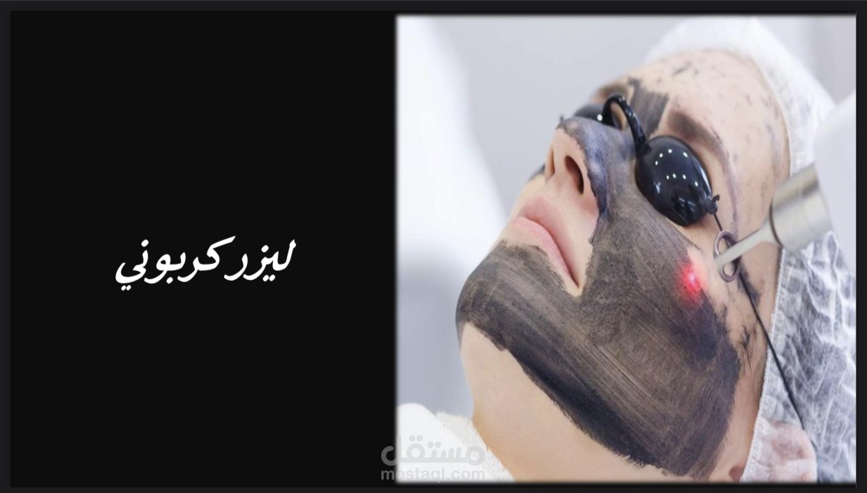 ليزر كربوني