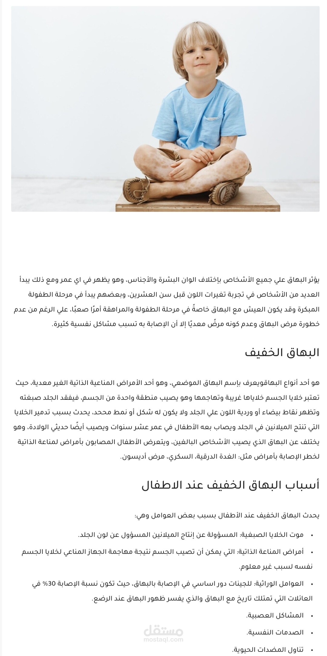 البهاق الخفيف عند الاطفال