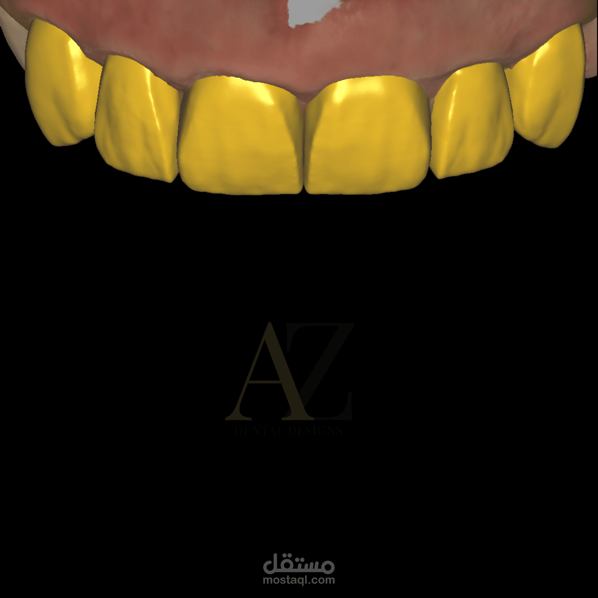 تصميم تركيبات اسنان ديجيتال