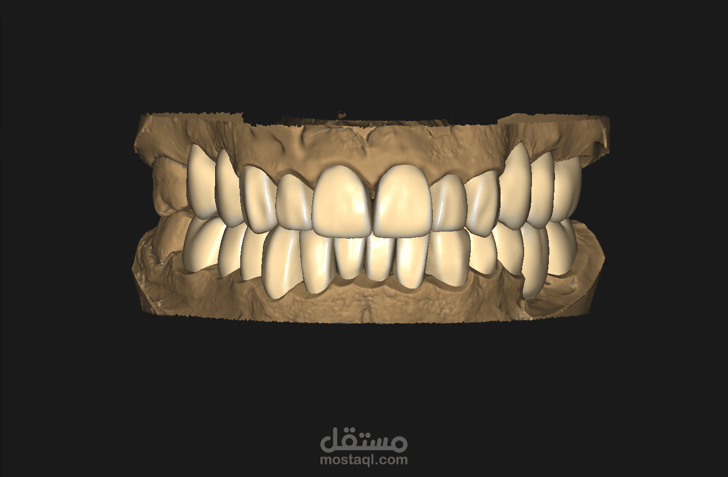 تصميم تركيبات اسنان ديجيتال