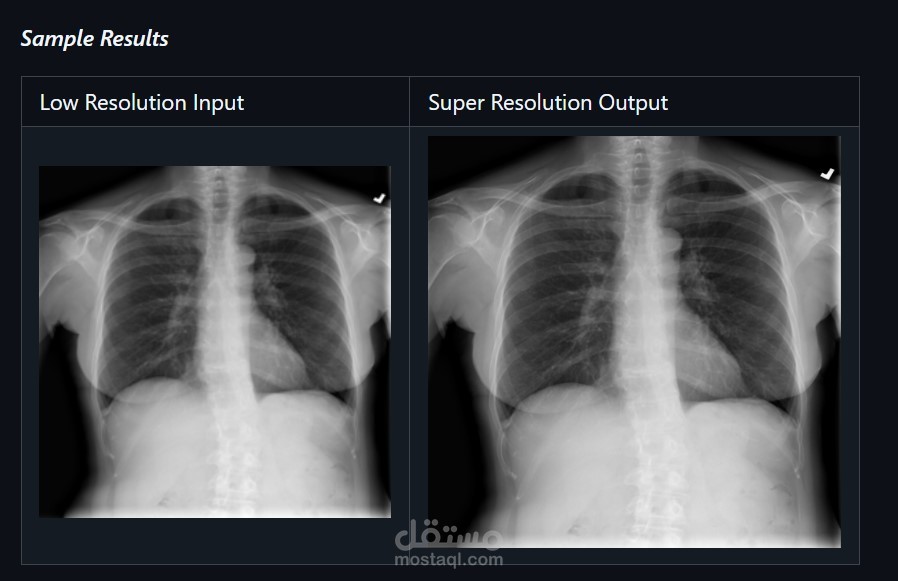 رفع دقة الصور الطبية (X-Ray) وتحسين جودتها باستخدام الذكاء الاصطناعي