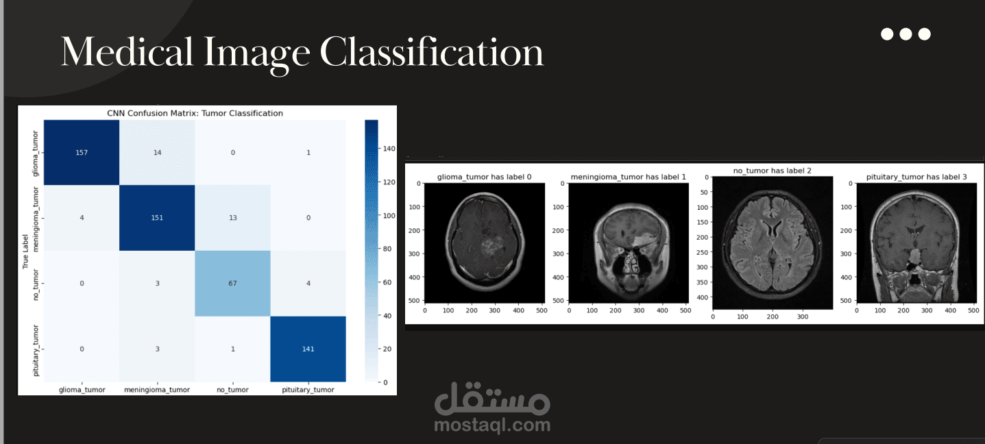 Medical Image Classification