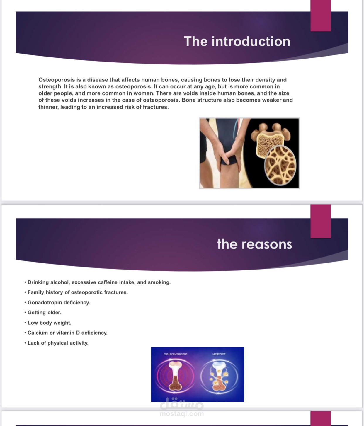 Osteoporosis