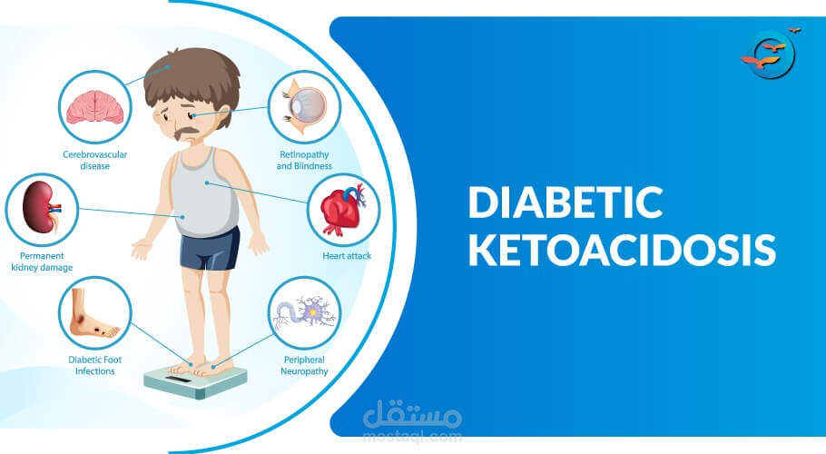 ملخص شرح dka لطلاب الطب