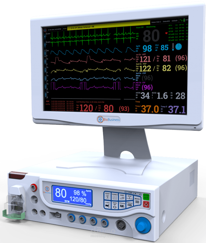 patient monitor