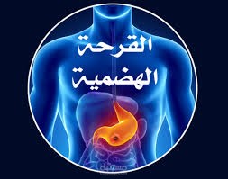 عرض تقديمي، موضوع طبي، بحث طبي، القرحة الهضمية