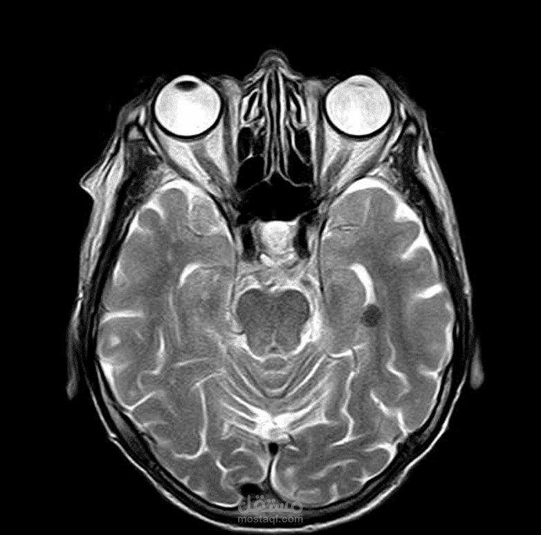 medical images analysis