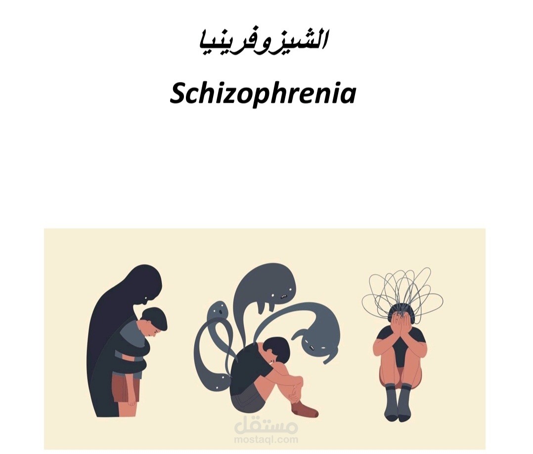 الشيزوفرينيا بين الفيزيولوجيا والأدوية المتعارف عليها وماهو الجديد في العلاج؟