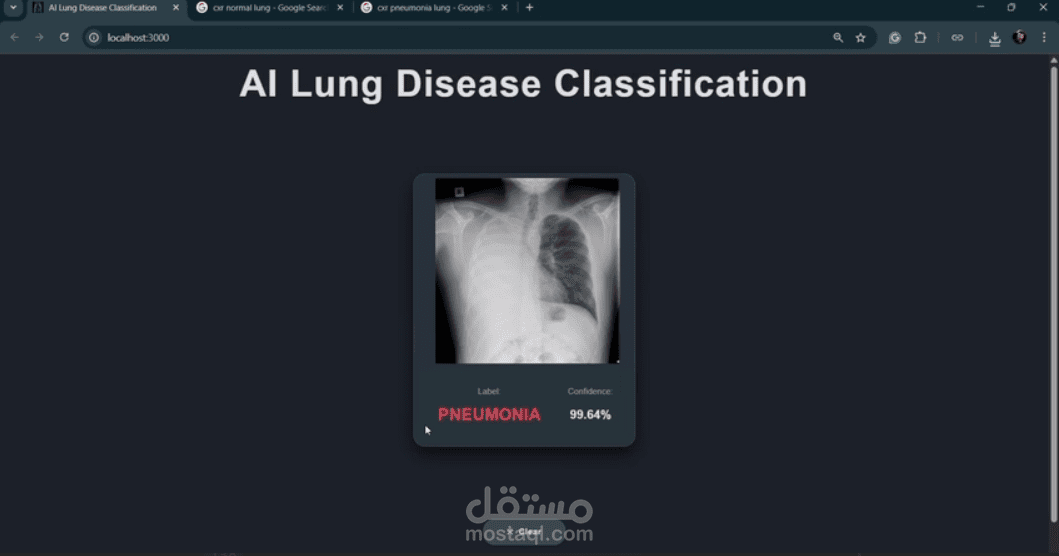 AI - LUNG DIESEASE CLASSIFICATION PROJECT