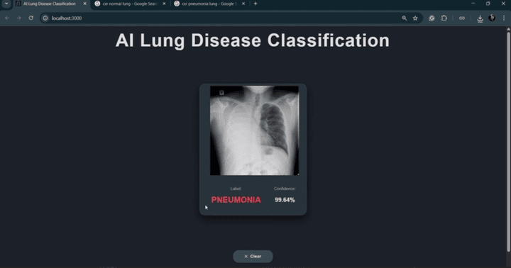 AI - LUNG DIESEASE CLASSIFICATION PROJECT