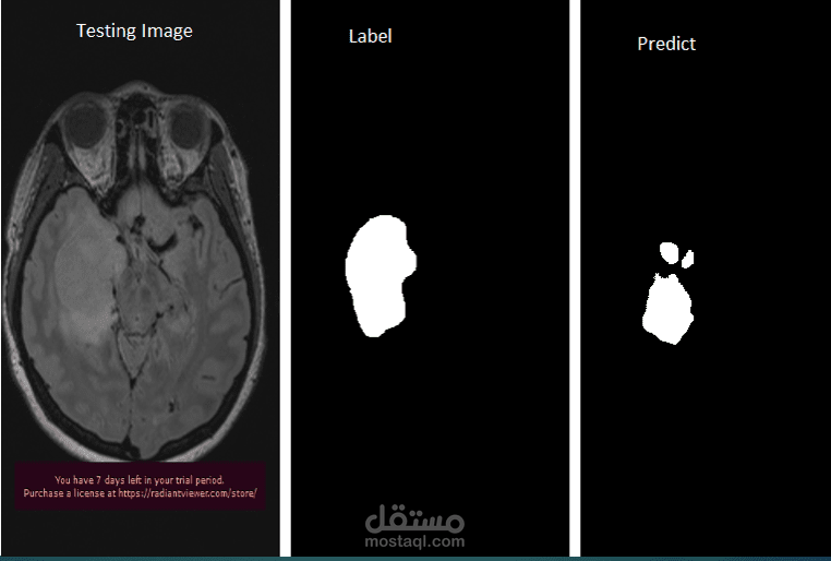 عمل بحث  بستخدام الذكاءالاصطناعى و التعلم العميق خاص ب أمكانية تطوير شبكة عصبية خاصة بأكتشاف و تحديد اماكن الاورام الموجوده فى المخ
