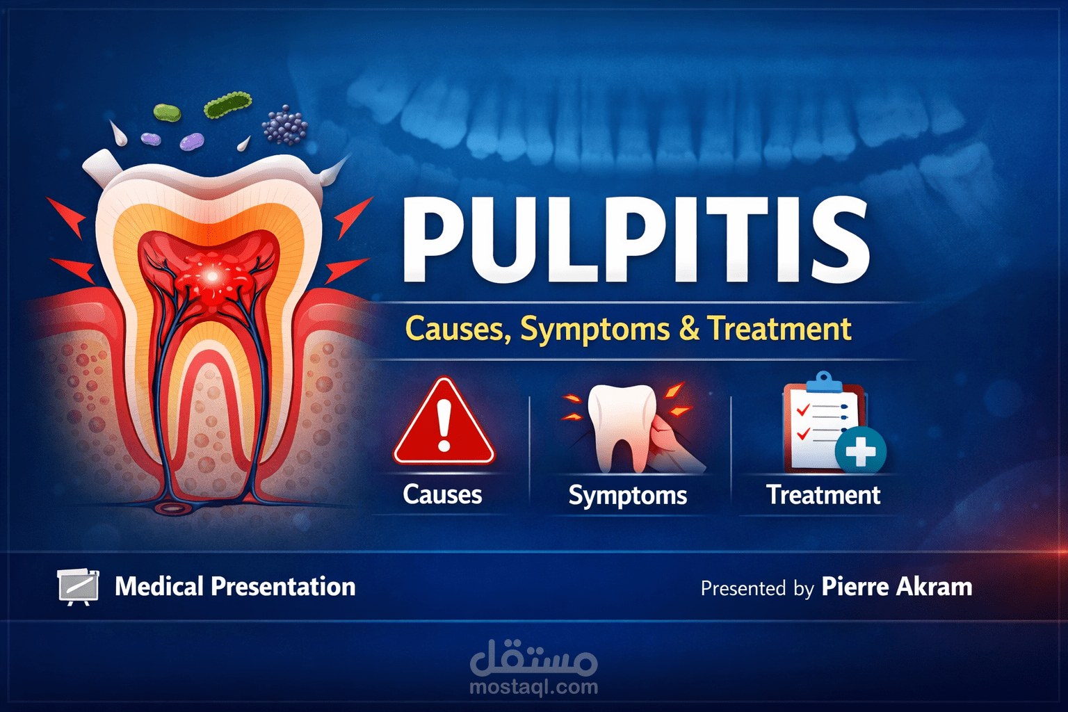 Medical PowerPoint Presentation – Pulpitis