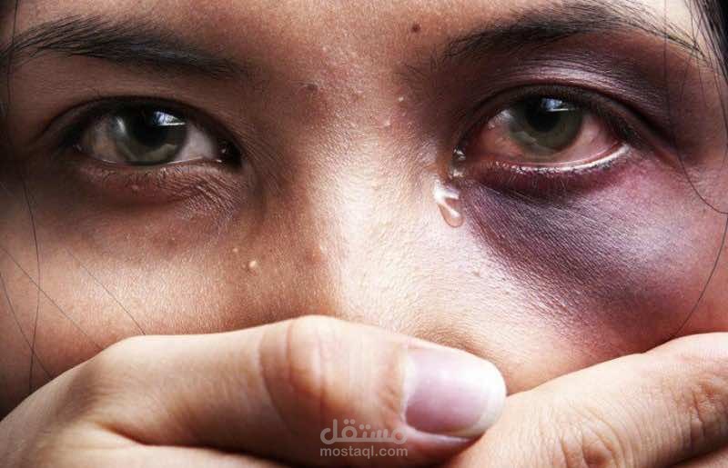 فترة الإغلاق..واقع لايطاق