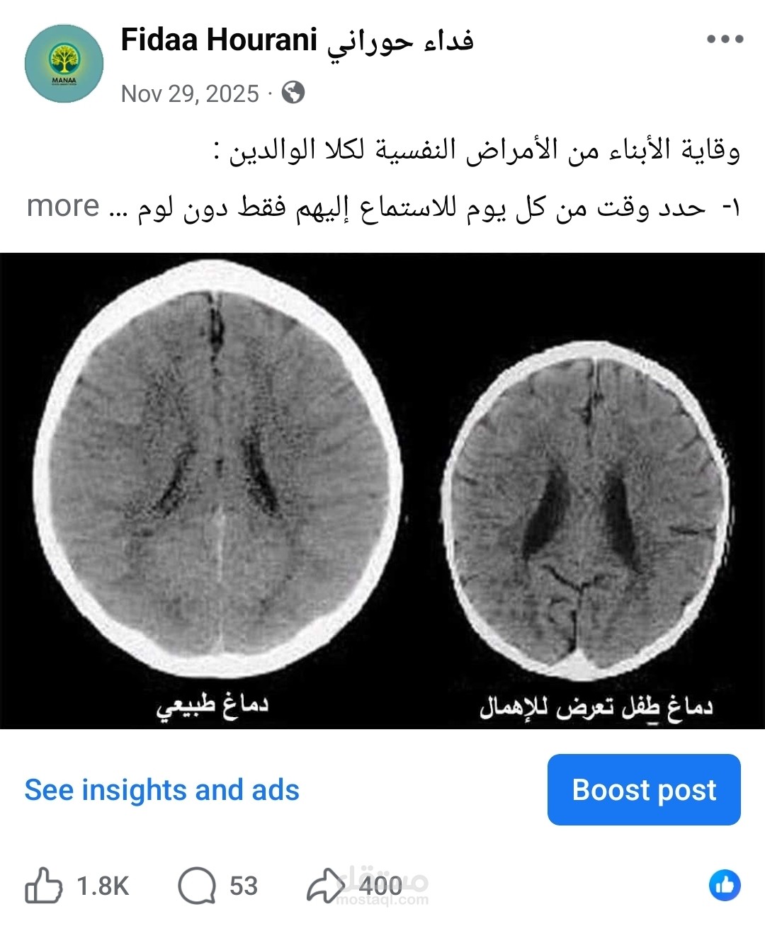 كتابة المحتوى لصفحات الهبوط والمنشورات