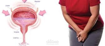 overactive bladder