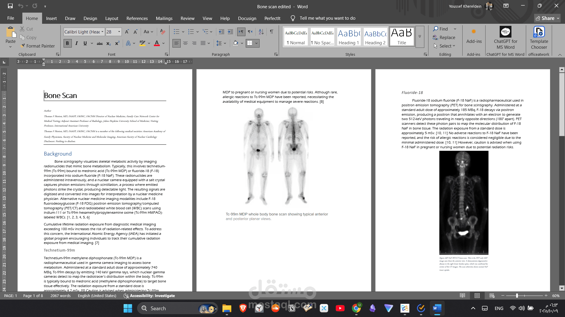Bone scan overview edited