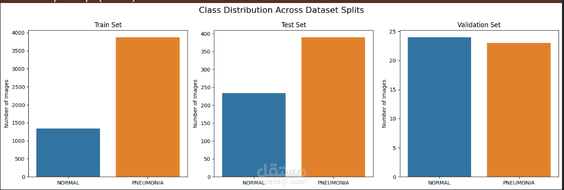 Pneumonia Detection from Chest X-ray Images using Deep Learning