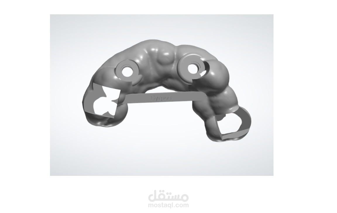 تخطيط للعمليات الجراحية