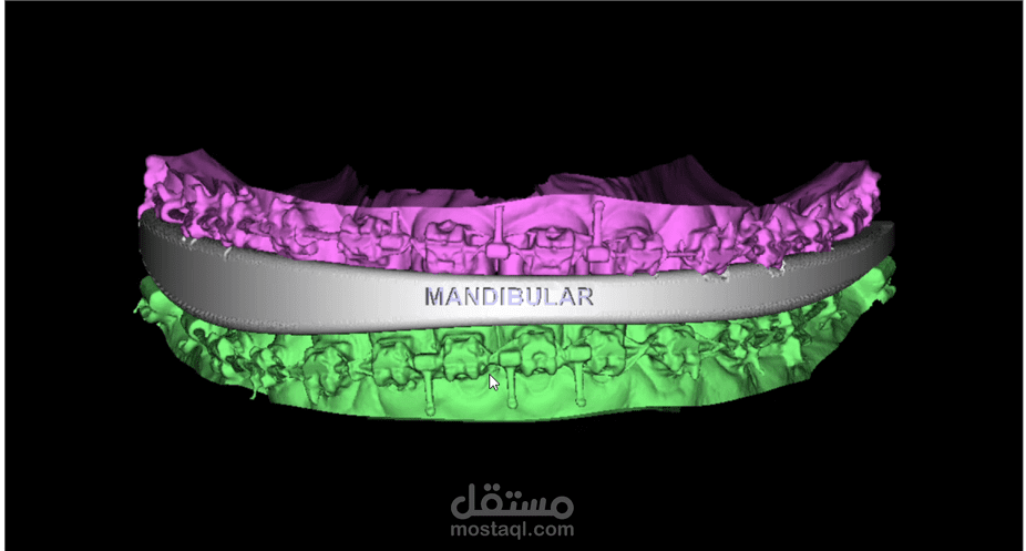 تخطيط للعمليات الجراحية