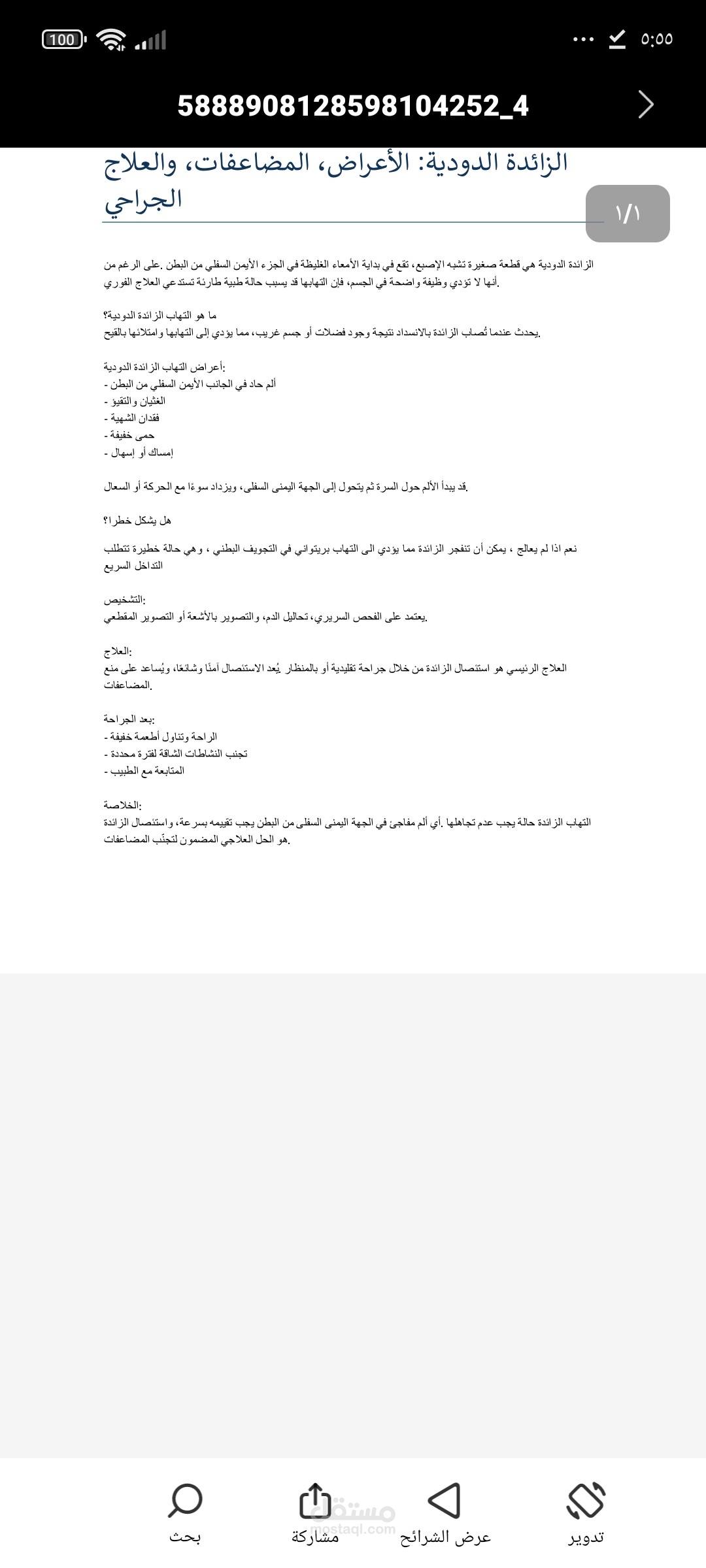 الزائدة الدودية
