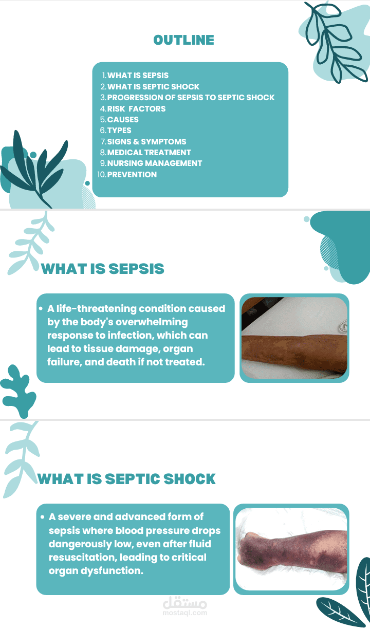عرض تقديمي عن septic shock