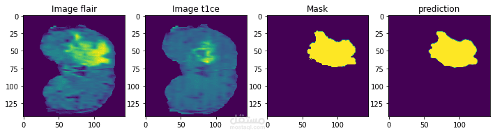 Brain Tumor Segmentation