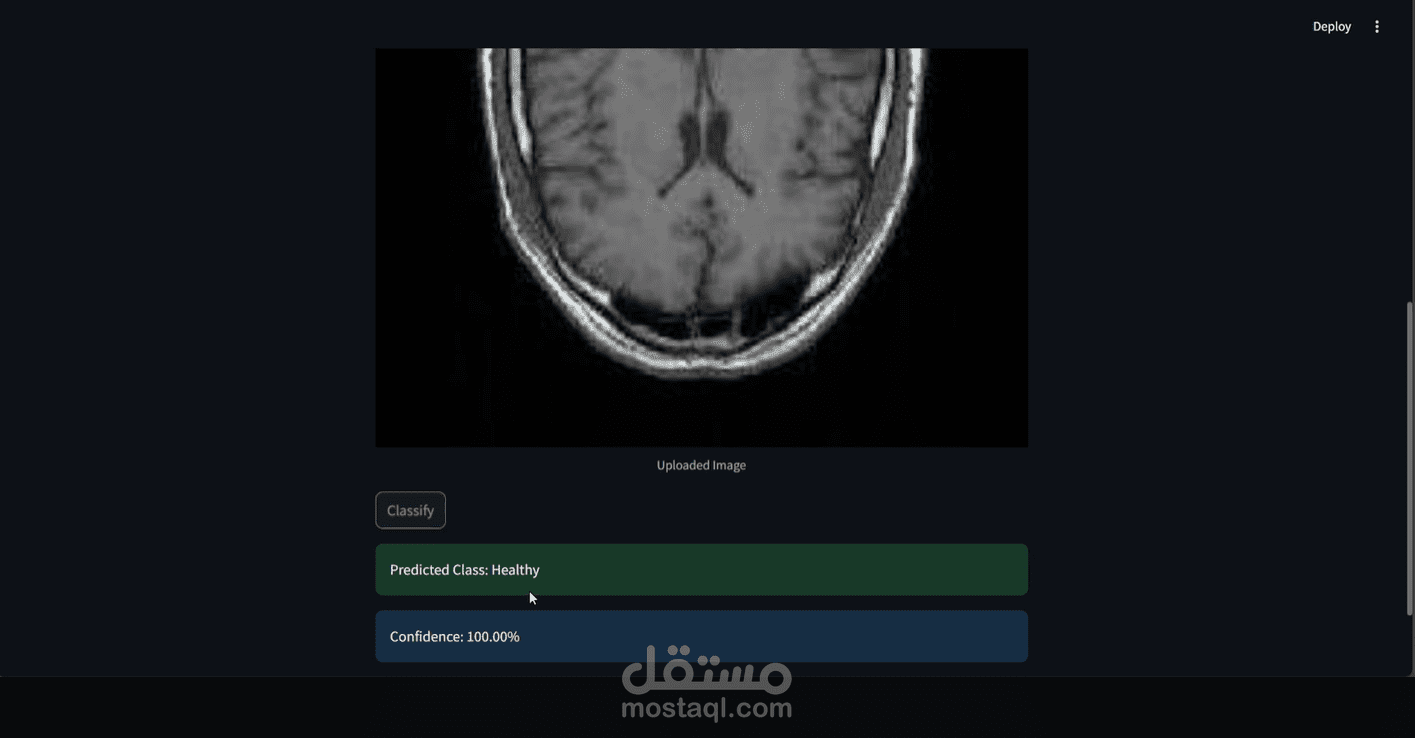 a Brain Tumor MRI Classification System