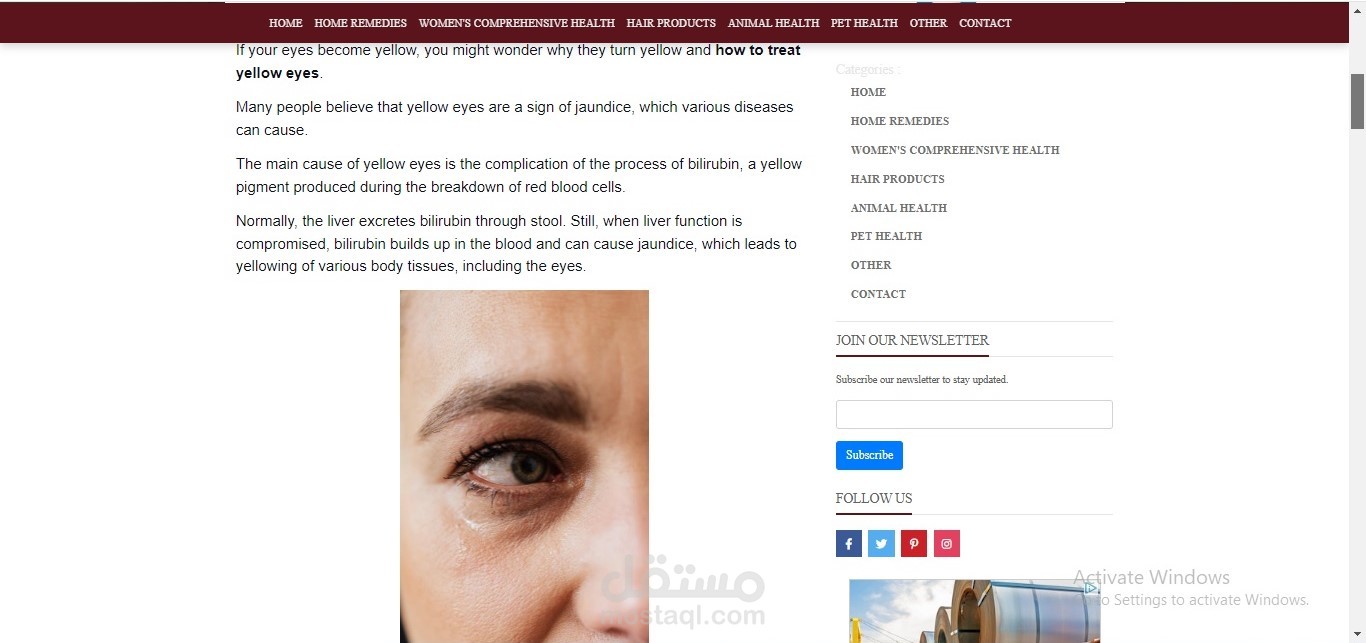 How to treat yellow eyes 13 ways to reduce yellowing of the eyes