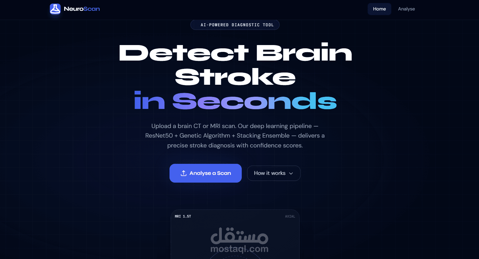 AI Brain Stroke Detection System