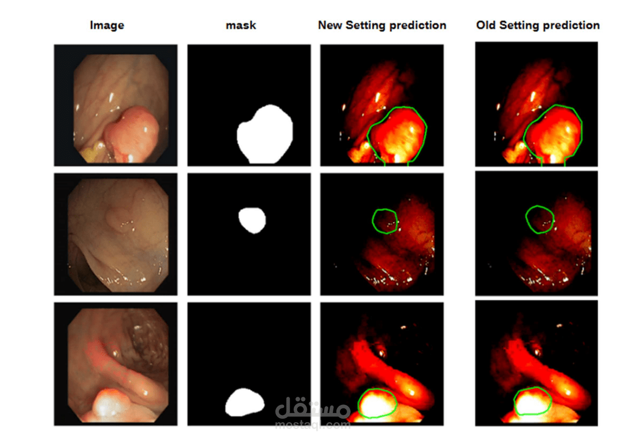 Medical Image Segmentation using Swin Transformer (AI Model)