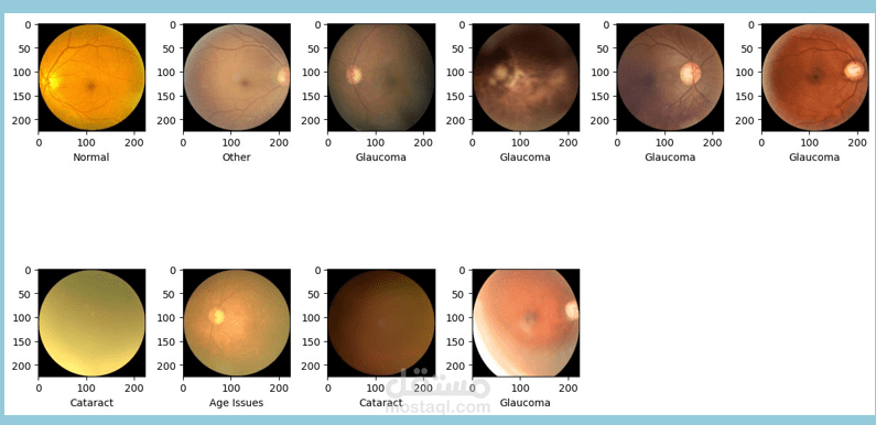 Ocular Disease Recognition