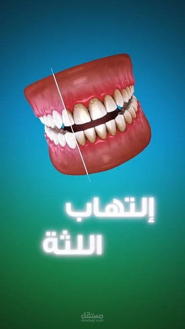 فيديو طبي - مستشفي السعودي الالماني