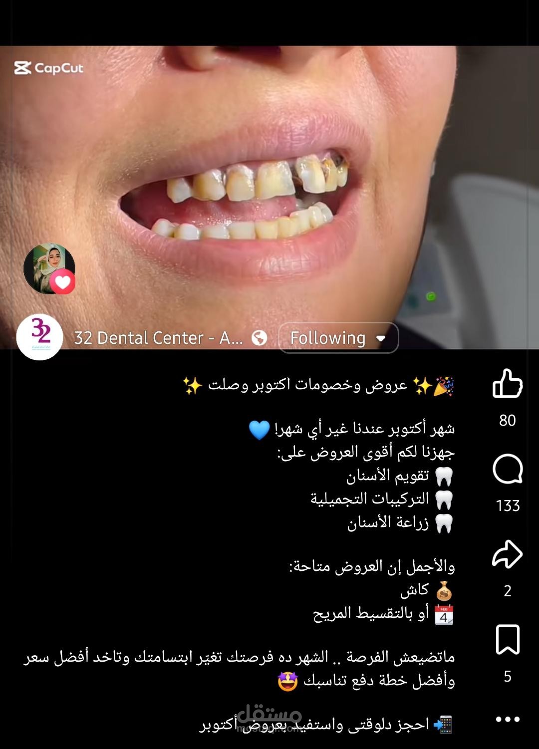 ريل دعائى لمركز أسنان (ثيرتي تو)
