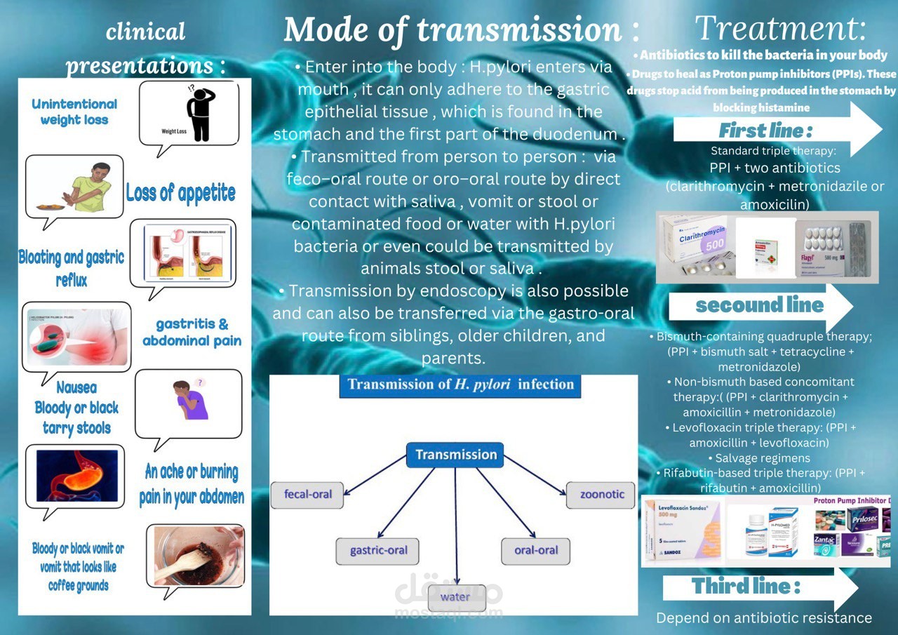 flyer about h.bylori الجرثومة المسئولة عن جرثومة المعدة